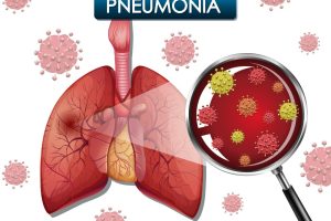 Pneumonia